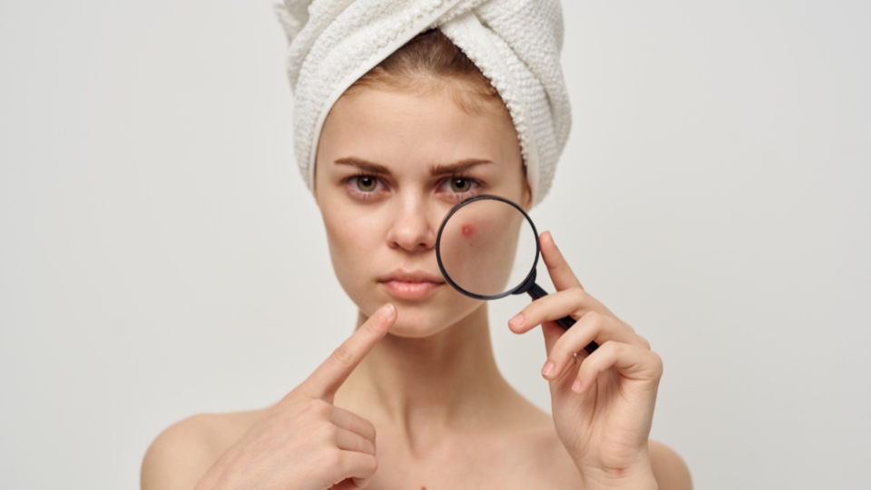 Les secrets pour combattre les boutons sur le visage des adultes - Mode Reine